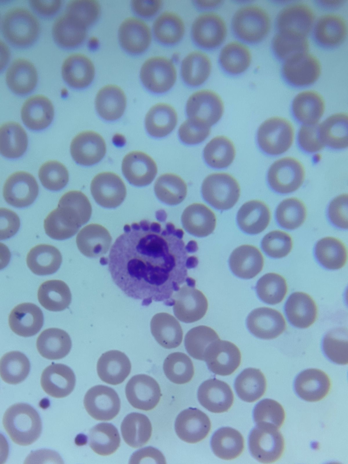 Lentes do Microscópio